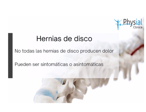 Hernias de disco en Sevilla Centro